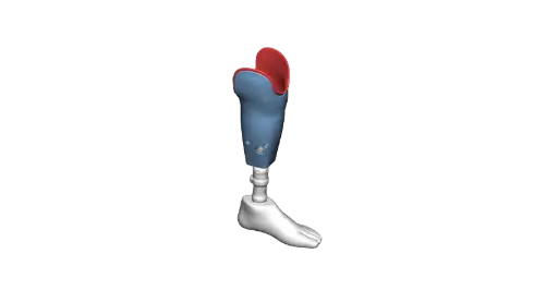 Prosthetic Socket